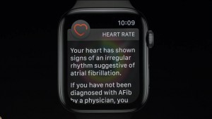 05-applewatch4-electrocardiogram.jpg