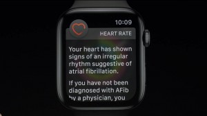 05-applewatch4-electrocardiogram_thumb.jpg