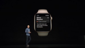 17-applewatch4-electrocardiogram.jpg