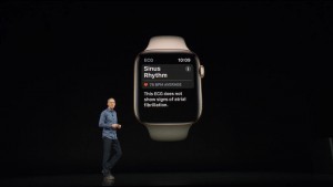 17-applewatch4-electrocardiogram_thumb.jpg