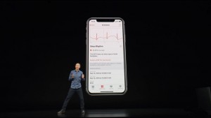 19-applewatch4-electrocardiogram.jpg
