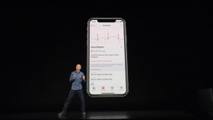 19-applewatch4-electrocardiogram_thumb.jpg